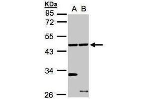 WB Image Sample(30 ug whole cell lysate) A:A431, B:Hep G2 , 10% SDS PAGE antibody diluted at 1:1000 (Ethanolamine Kinase 1 抗体)