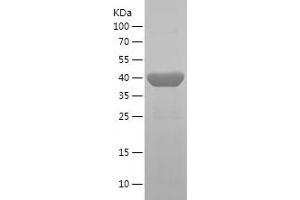 Desmin Protein (DES) (AA 142-467) (His tag)