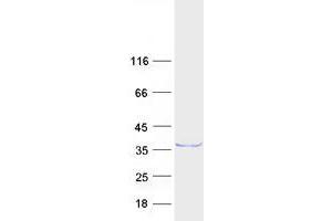 Western Blotting (WB) image for RING1 and YY1 Binding Protein (RYBP) protein (Myc-DYKDDDDK Tag) (ABIN2731281)