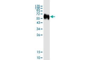 Image no. 2 for Interleukin 3 Receptor, alpha (IL3RA) (AA 19-305) protein (His-DYKDDDDK-Strep II Tag) (ABIN2752828)