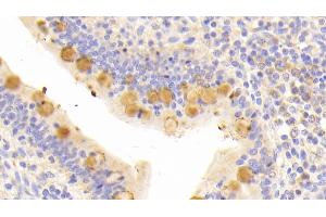 Immunohistochemistry (IHC) image for anti-Kininogen 1 (KNG1) (AA 225-407) antibody (ABIN7438388)