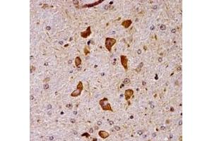 Immunohistochemistry (IHC) image for anti-P21 Protein (Cdc42/Rac)-Activated Kinase 7 (PAK7) (AA 128-157) antibody (ABIN3028909)
