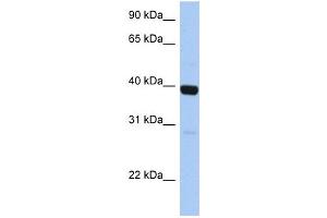 WB Suggested Anti-ZNF385B Antibody Titration:  0. (ZNF385B 抗体  (C-Term))