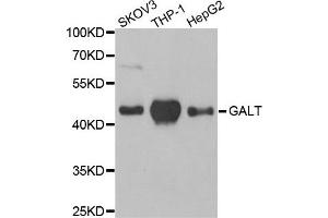 Western Blotting (WB) image for anti-Galactose-1-Phosphate Uridylyltransferase (GALT) antibody (ABIN1980308)