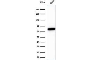Western Blot analysis of HeLa cell lysate using HSP60-Monospecific Mouse Monoclonal Antibody (HSPD1/780) (HSPD1 抗体)