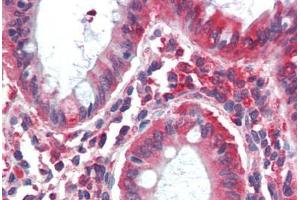 Human Colon (formalin-fixed, paraffin-embedded) stained with MYO5B antibody ABIN396915 at 20 ug/ml followed by biotinylated goat anti-rabbit IgG secondary antibody ABIN481713, alkaline phosphatase-streptavidin and chromogen. (MYO5B 抗体  (C-Term))
