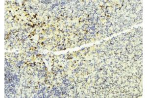 ABIN6274137 at 1/100 staining Mouse liver tissue by IHC-P.