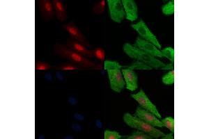 Phospho-MAFB (Ser304) Antibody staining A549 cells(H2O2 treatment) by IF/ICC. (MAFB 抗体  (pSer304))
