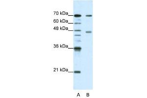 PABPC4 antibody used at 1. (PABPC4 抗体  (N-Term))