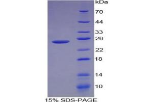 SDS-PAGE analysis of Human Caldesmon Protein. (Caldesmon 蛋白)