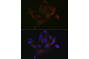 Immunofluorescence analysis of U-2 OS cells using B Rabbit mAb (ABIN1680181, ABIN7101458, ABIN7101459 and ABIN7101460) at dilution of 1:100 (40x lens). (BCAP31 抗体)