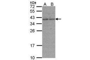 Image no. 1 for anti-X-Ray Repair Complementing Defective Repair in Chinese Hamster Cells 3 (XRCC3) (AA 1-128) antibody (ABIN467379) (XRCC3 抗体  (AA 1-128))