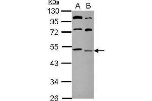WB Image Sample (20 ug of whole cell lysate) A: HeLa B: HeLa membrane 10% SDS PAGE antibody diluted at 1:500 (LCLAT1 抗体)