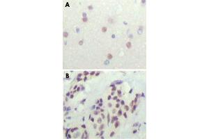Immunohistochemical analysis of paraffin-embedded human cerebra (A) and breast carcinoma tissue (B), showing nuclear location.
