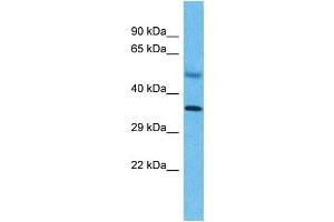 Host:  Rabbit  Target Name:  SNAPC2  Sample Type:  Liver Tumor lysates  Antibody Dilution:  1. (SNAPC2 抗体  (C-Term))