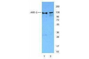 Western Blotting (WB) image for anti-WD Repeat and HMG-Box DNA Binding Protein 1 (WDHD1) antibody (ABIN2664053) (WDHD1 抗体)