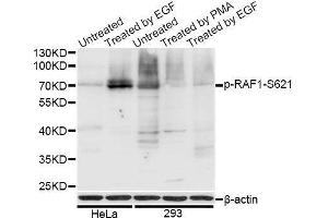 Western blot analysis of extracts of HeLa and 293T cells, using Phospho-RAF1-S621 antibody (ABIN5969931) at 1/1000 dilution. (RAF1 抗体  (pSer621))