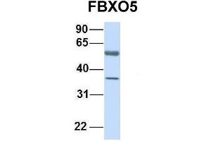 Host:  Rabbit  Target Name:  FBXO5  Sample Type:  Human Fetal Lung  Antibody Dilution:  1. (FBXO5 抗体  (C-Term))