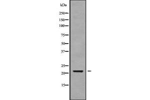 Western blot analysis of CALML6 using Jurkat whole cell lysates (CALML6 抗体)