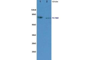 L1 rat kidney lysates L2 rat pancreas lysates probed with Anti NLG1/KIRREL2 Polyclonal Antibody, Unconjugated (ABIN720460) at 1:200 in 4 °C. (KIRREL2 抗体  (AA 165-260))