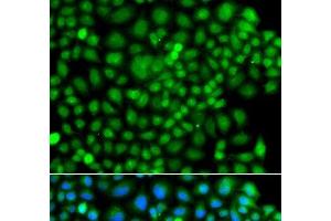 Immunofluorescence analysis of A549 cells using SUMO4 Polyclonal Antibody (SUMO4 抗体)