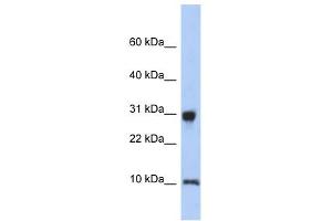 RPS21 antibody used at 1 ug/ml to detect target protein. (RPS21 抗体  (N-Term))