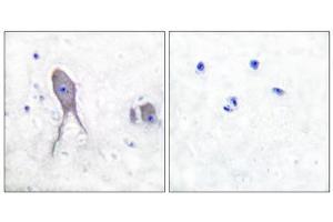 Immunohistochemical analysis of paraffin-embedded human brain tissue, using Notch 2 (cleaved-Asp1733) antibody. (NOTCH2 抗体  (Cleaved-Asp1733))