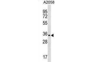 Western Blotting (WB) image for anti-Olfactory Receptor, Family 2, Subfamily T, Member 35 (OR2T35) antibody (ABIN3000665) (OR2T35 抗体)