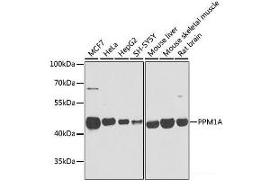 Western blot analysis of extracts of various cell lines using PPM1A Polyclonal Antibody at dilution of 1:1000. (PPM1A 抗体)
