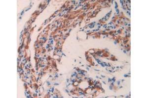 IHC-P analysis of Mouse Ovary Tissue, with DAB staining. (GAS6 抗体  (AA 483-646))