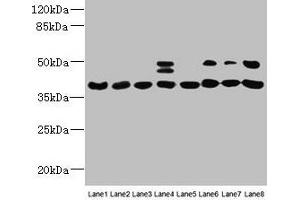 Western blot All lanes: HIF1AN antibody at 12 μg/mL Lane 1: Mouse heart tissue Lane 2: Mouse skeletal muscle tissue Lane 3: K562 whole cell lysate Lane 4: MCF-7 whole cell lysate Lane 5: HL60 whole cell lysate Lane 6: 293T whole cell lysate Lane 7: Jurkat whole cell lysate Lane 8: A375 whole cell lysate Secondary Goat polyclonal to rabbit IgG at 1/10000 dilution Predicted band size: 41 kDa Observed band size: 41, 48 kDa (HIF1AN 抗体  (AA 2-254))