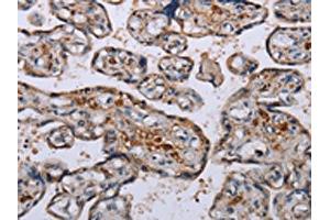 The image on the left is immunohistochemistry of paraffin-embedded Human placenta tissue using ABIN7130075(LEPREL2 Antibody) at dilution 1/50, on the right is treated with fusion protein. (LEPREL2 抗体)