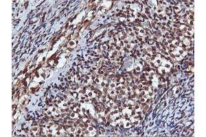 Image no. 2 for anti-V-Akt Murine Thymoma Viral Oncogene Homolog 1 (AKT1) antibody (ABIN1496557) (AKT1 抗体)