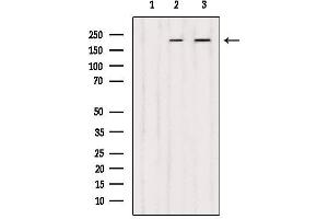 Western blot analysis of extracts from various samples, using DOCK1 Antibody. (DOCK1 抗体  (C-Term))