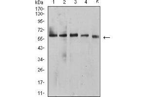 Western blot analysis using BTN1A1 mouse mAb against HepG2 (1), MCF-7 (2), SK-BR-3 (3), NIH/3T3 (4), and C6 (5) cell lysate. (BTN1A1 抗体  (AA 27-242))