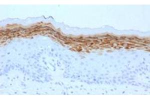 Immunohistochemical staining (Formalin-fixed paraffin-embedded sections) of human skin with FLG monoclonal antibody, clone FLG/1561 .