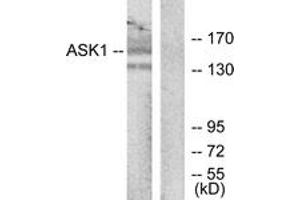 Western blot analysis of extracts from RAW264. (ASK1 抗体  (AA 932-981))