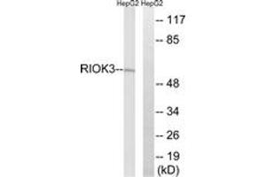 Western blot analysis of extracts from HepG2 cells, using RIOK3 Antibody. (RIOK3 抗体  (AA 271-320))