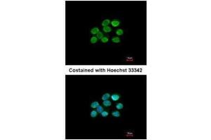 ICC/IF Image Immunofluorescence analysis of paraformaldehyde-fixed A431, using KAP1, antibody at 1:200 dilution. (KAP1 抗体)