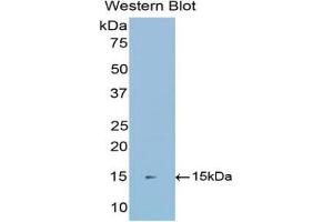 Western Blotting (WB) image for anti-Cadherin 1, Type 1, E-Cadherin (Epithelial) (CDH1) (AA 153-264) antibody (ABIN2901801)