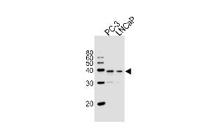 Western blot analysis of lysates from PC-3, LNCaP cell line (from left to right), using VDR Antibody at 1:1000 at each lane. (VD (AA 274-299) 抗体)