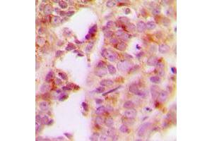 Immunohistochemistry (IHC) image for anti-Insulin Receptor Substrate 1 (IRS1) (Center) antibody (ABIN7300884)