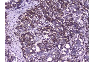 IHC analysis of CIC using anti-CIC antibody (ABIN6719536). (CIC 抗体  (AA 1433-1527))