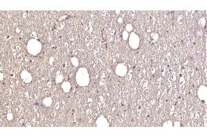 Detection of GRIA2 in Human Cerebellum Tissue using Monoclonal Antibody to Glutamate Receptor, Ionotropic, AMPA 2 (GRIA2) (GRIA2 抗体  (AA 413-527))