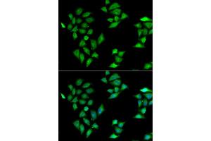Immunofluorescence analysis of HeLa cell using ITLN1 antibody. (ITLN1/Omentin 抗体)