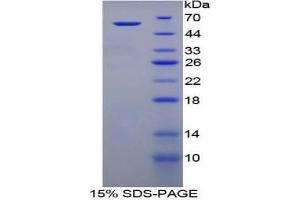 SDS-PAGE analysis of Human TGM1 Protein.