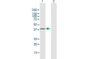 Western Blot analysis of CISH expression in transfected 293T cell line by CISH MaxPab polyclonal antibody. (CISH 抗体  (AA 1-258))