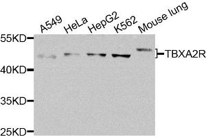 Western blot analysis of extracts of various cells, using TBXA2R antibody. (TBXA2R 抗体)