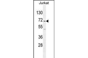 GAD2 Antibody (Center) (ABIN655070 and ABIN2844700) western blot analysis in Jurkat cell line lysates (35 μg/lane). (GAD65 抗体  (AA 109-138))