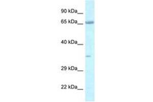 Image no. 1 for anti-Leucine Zipper, Putative Tumor Suppressor 1 (LZTS1) (AA 530-579) antibody (ABIN6747423) (LZTS1 抗体  (AA 530-579))